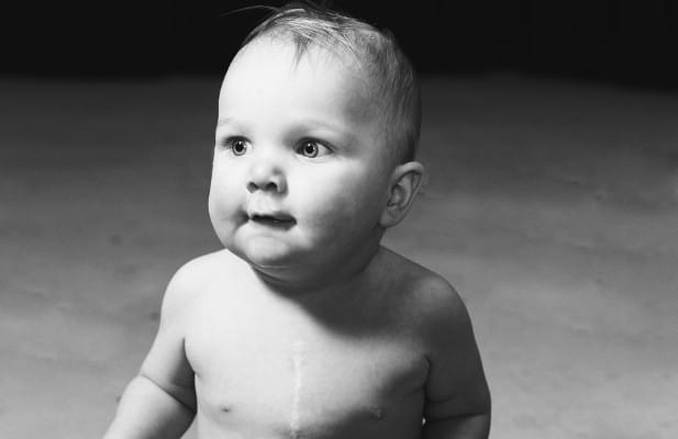 Helping to Fight Congenital Heart Disease